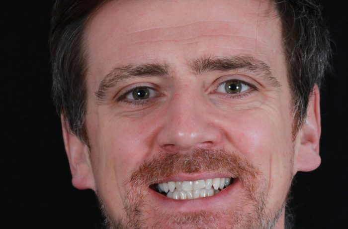 Before - Cheadle Hulme Dental