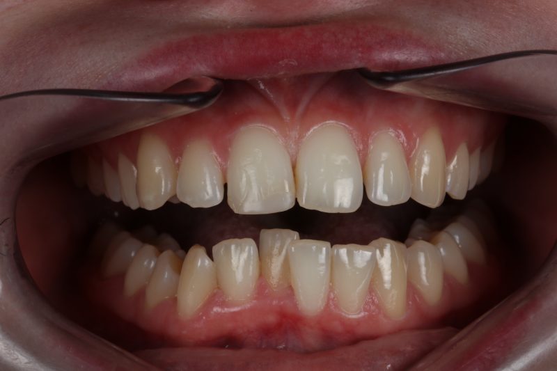 Before - Cheadle Hulme Dental