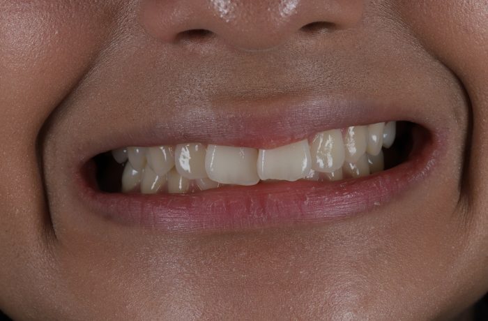 Before - Cheadle Hulme Dental