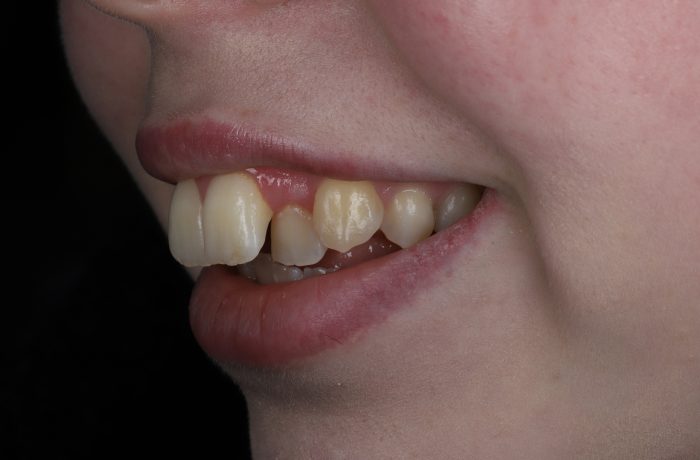 Before - Cheadle Hulme Dental