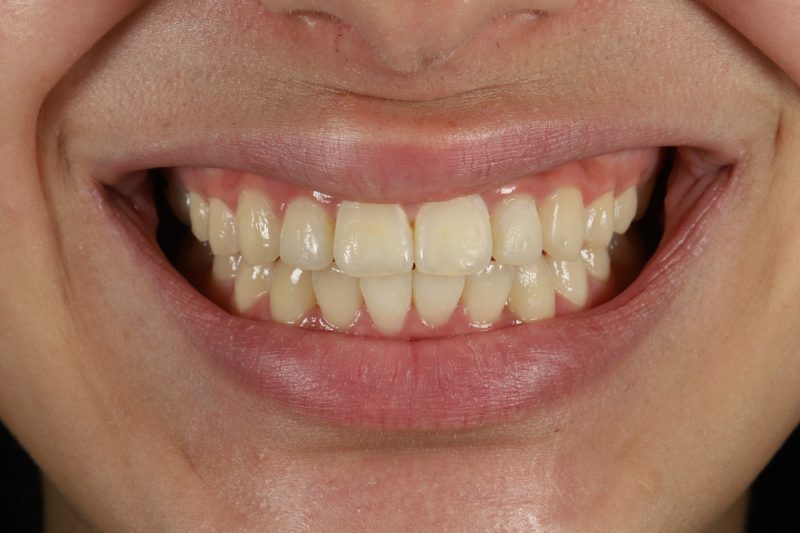 After - Cheadle Hulme Dental