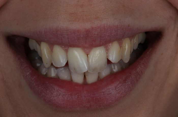 Before - Cheadle Hulme Dental