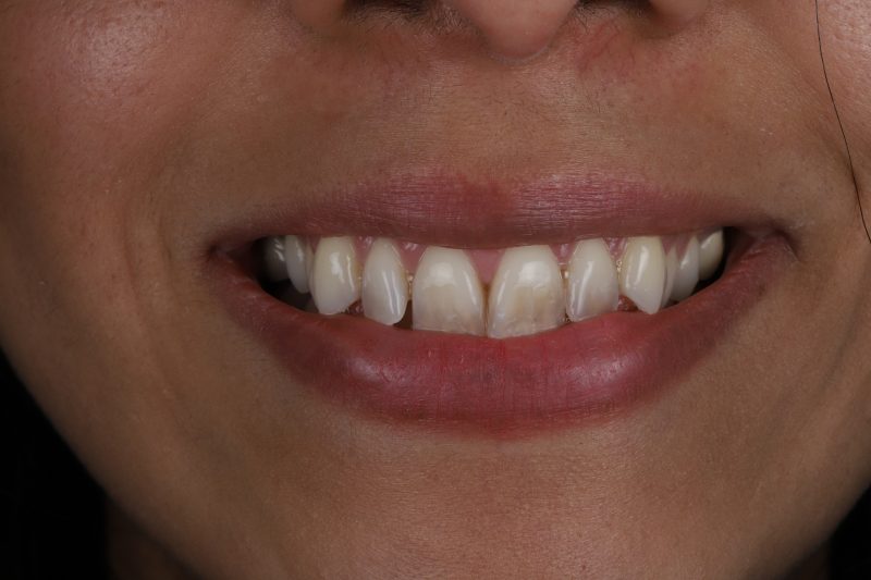 Before - Cheadle Hulme Dental