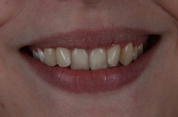 Before - Cheadle Hulme Dental