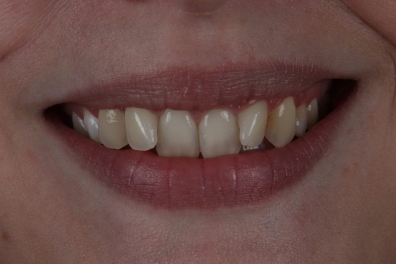 Before - Cheadle Hulme Dental