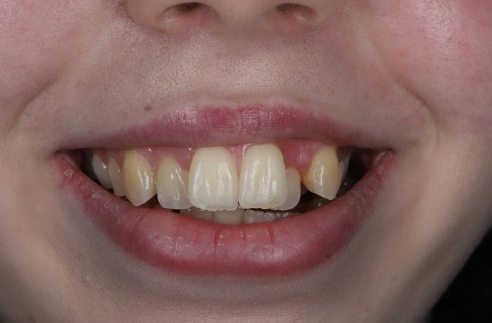 Before - Cheadle Hulme Dental