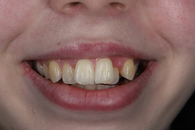 Before - Cheadle Hulme Dental