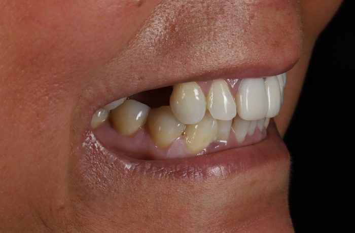 Before - Cheadle Hulme Dental