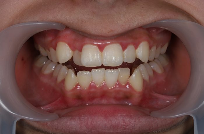 Before - Cheadle Hulme Dental