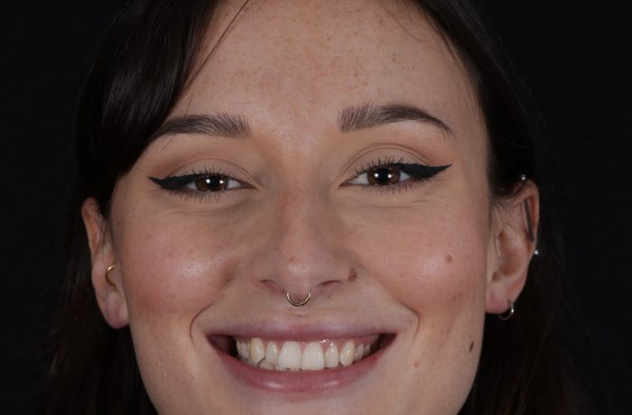 Before - Cheadle Hulme Dental