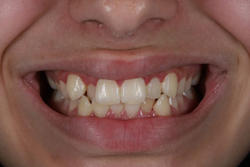 Before - Cheadle Hulme Dental