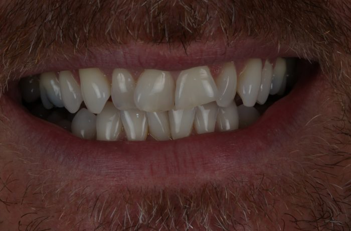 Before - Cheadle Hulme Dental