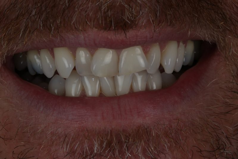 Before - Cheadle Hulme Dental