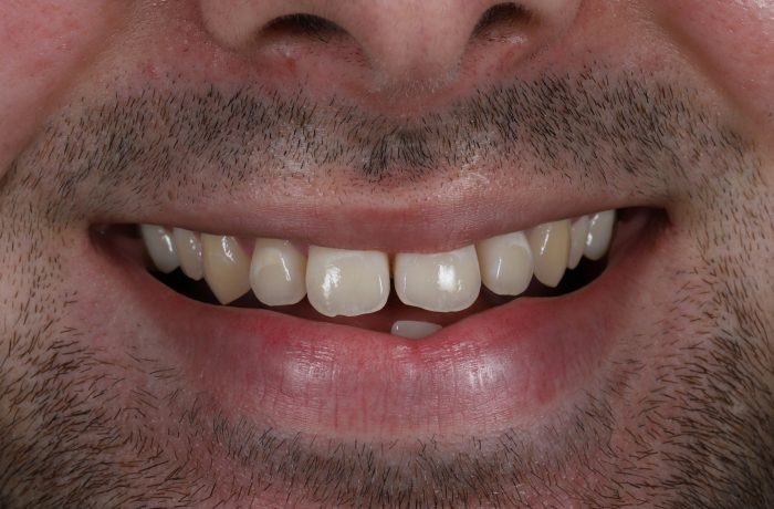 Before - Cheadle Hulme Dental