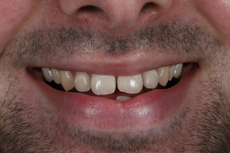 Before - Cheadle Hulme Dental