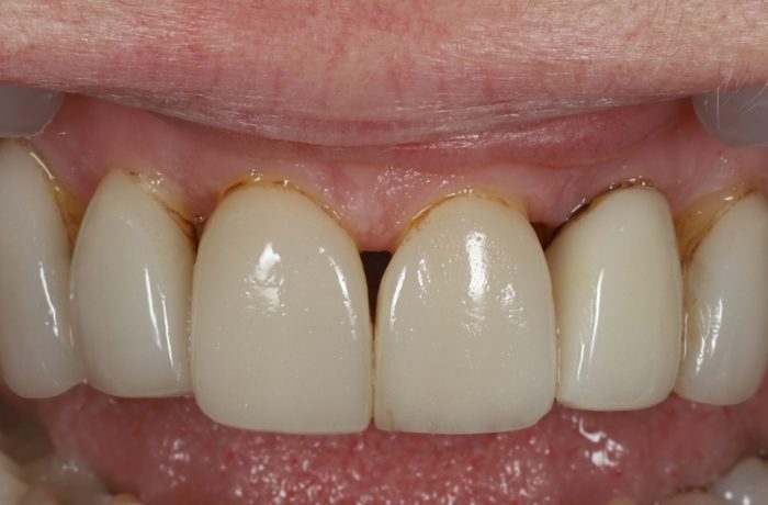 Before - Cheadle Hulme Dental
