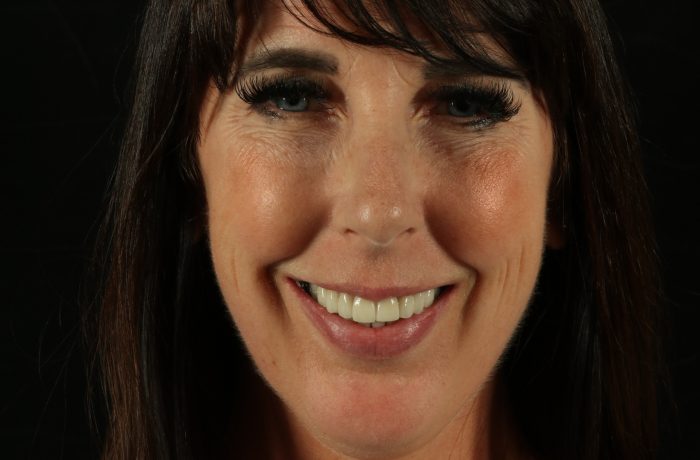 After - Cheadle Hulme Dental