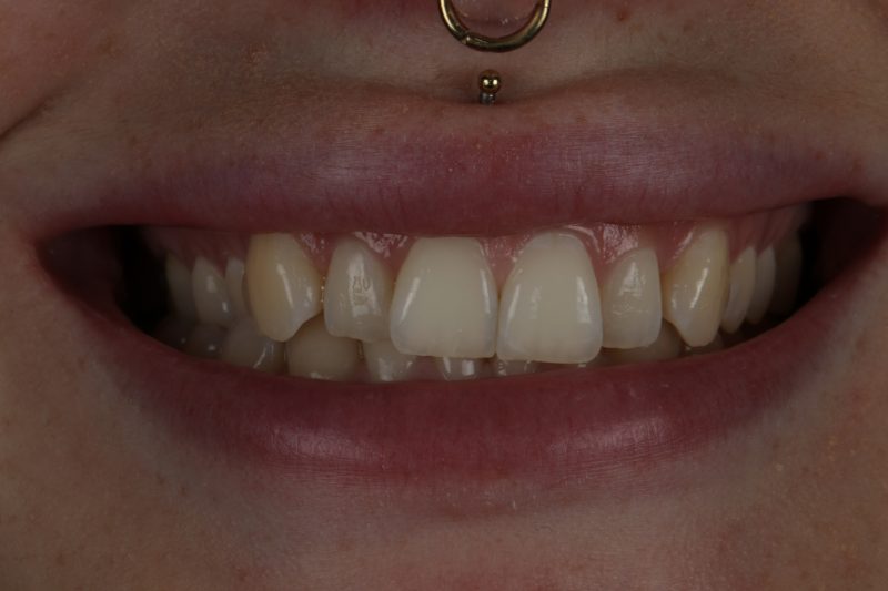 Before - Cheadle Hulme Dental