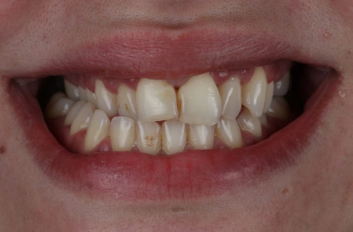 Before - Cheadle Hulme Dental