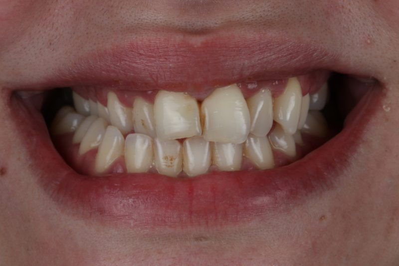 Before - Cheadle Hulme Dental
