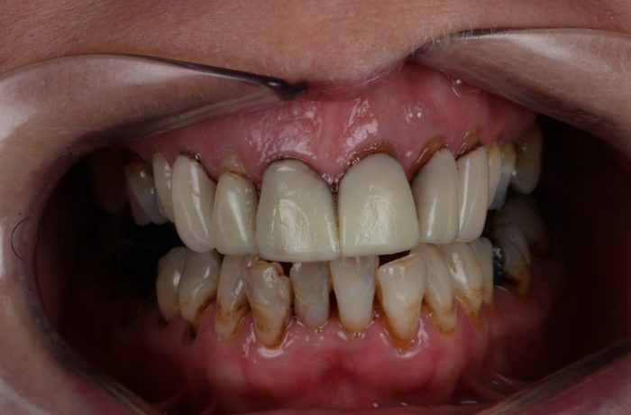 Before - Cheadle Hulme Dental
