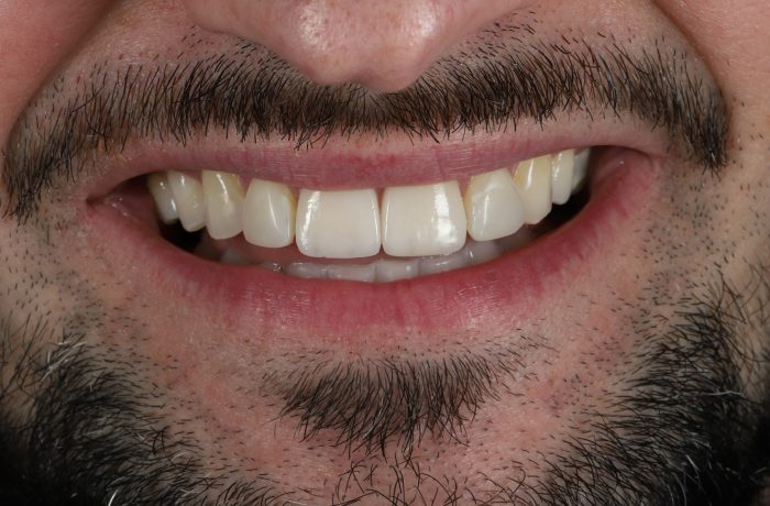 After - Cheadle Hulme Dental