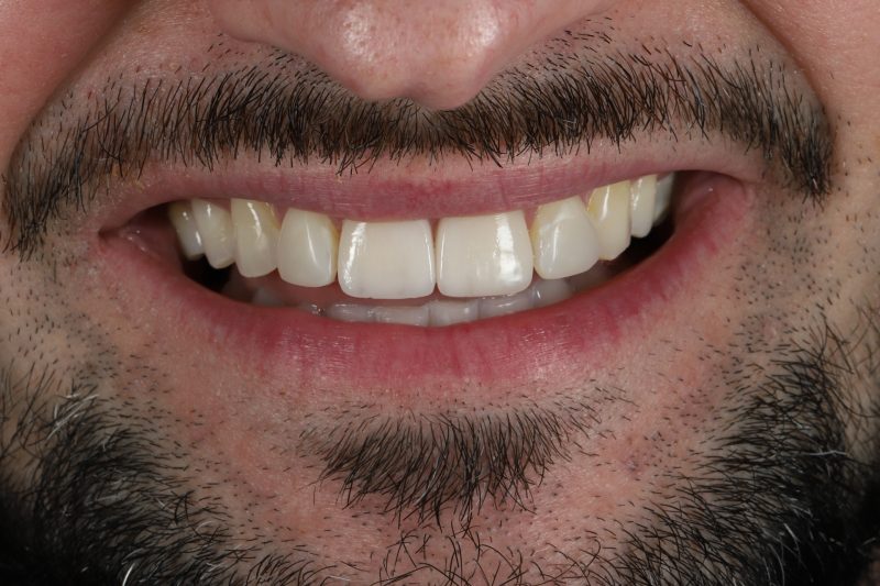 After - Cheadle Hulme Dental