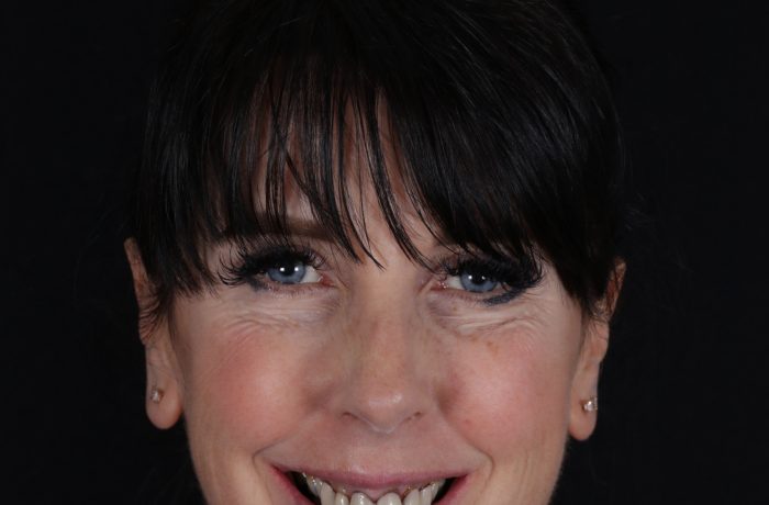 Before - Cheadle Hulme Dental