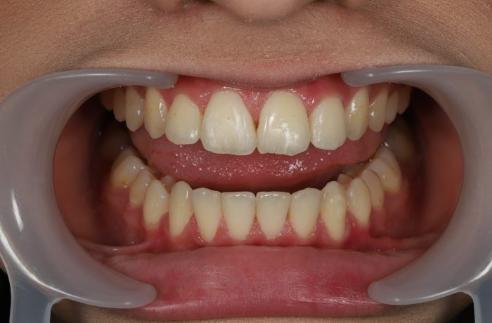 After - Cheadle Hulme Dental