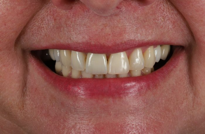 After - Cheadle Hulme Dental