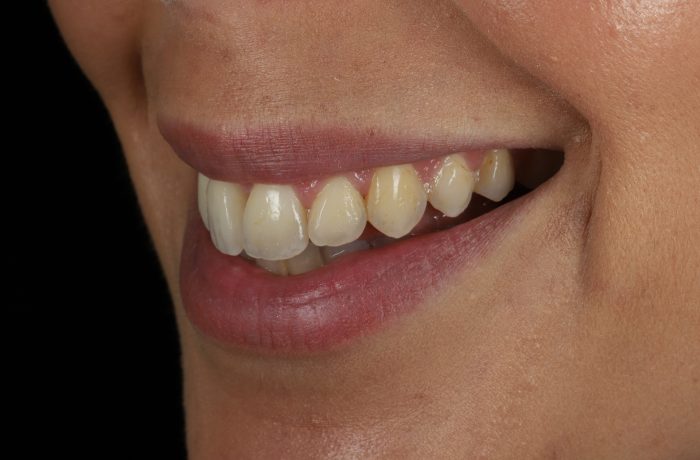 After - Cheadle Hulme Dental
