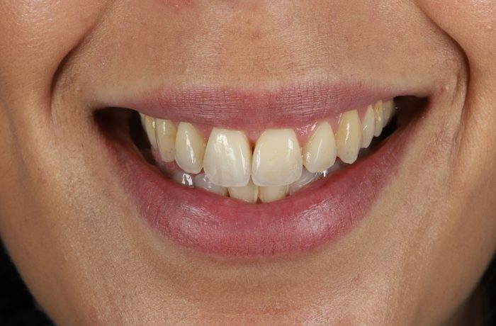 After - Cheadle Hulme Dental