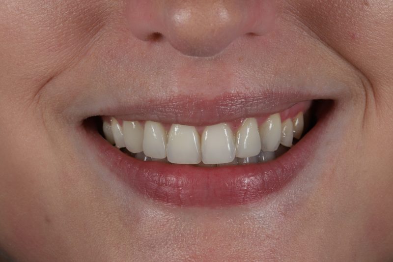 After - Cheadle Hulme Dental