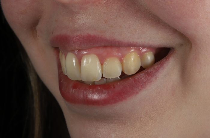 After - Cheadle Hulme Dental
