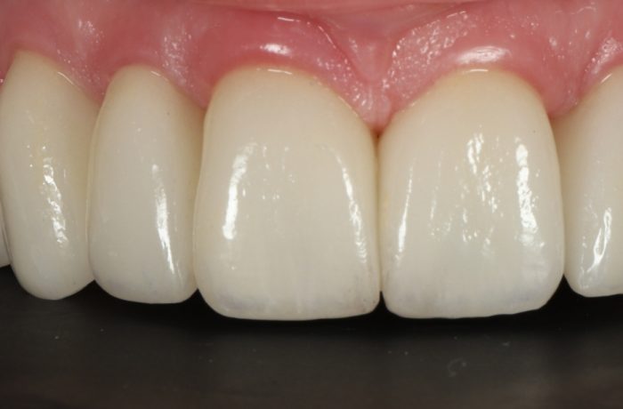 After - Cheadle Hulme Dental