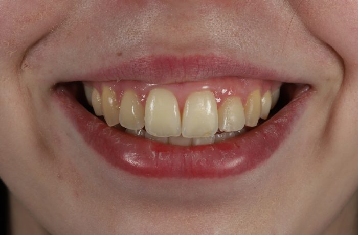 After - Cheadle Hulme Dental