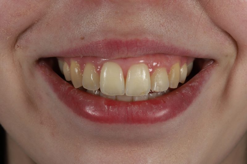 After - Cheadle Hulme Dental