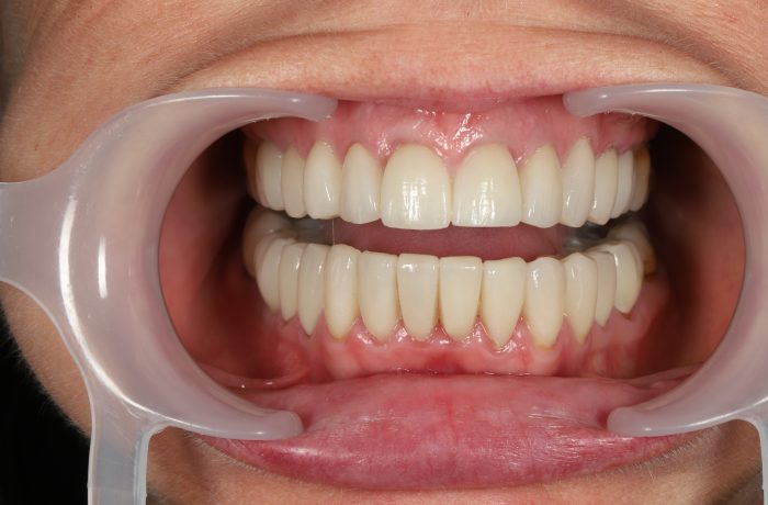 After - Cheadle Hulme Dental