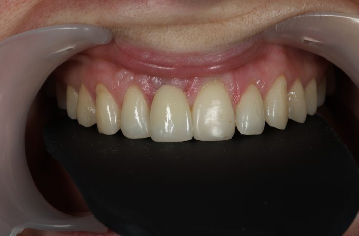 After - Cheadle Hulme Dental
