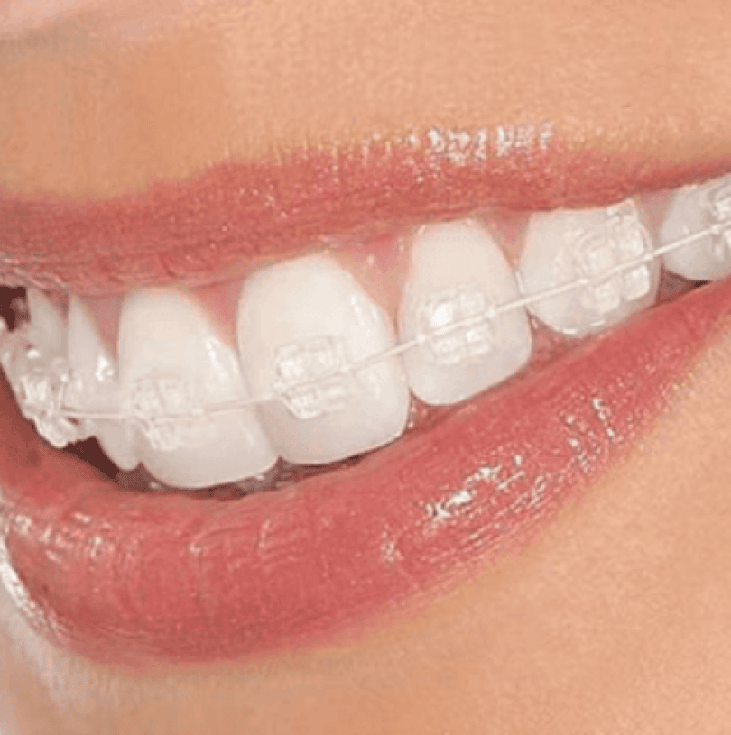 blog - Cheadle Hulme Dental