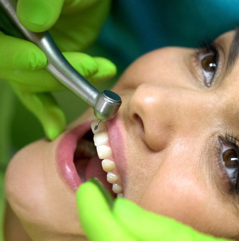 Chipped Tooth Repair: Your Path to a Perfect Smile
