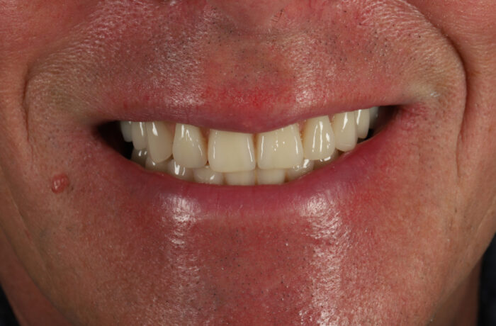 After - Cheadle Hulme Dental