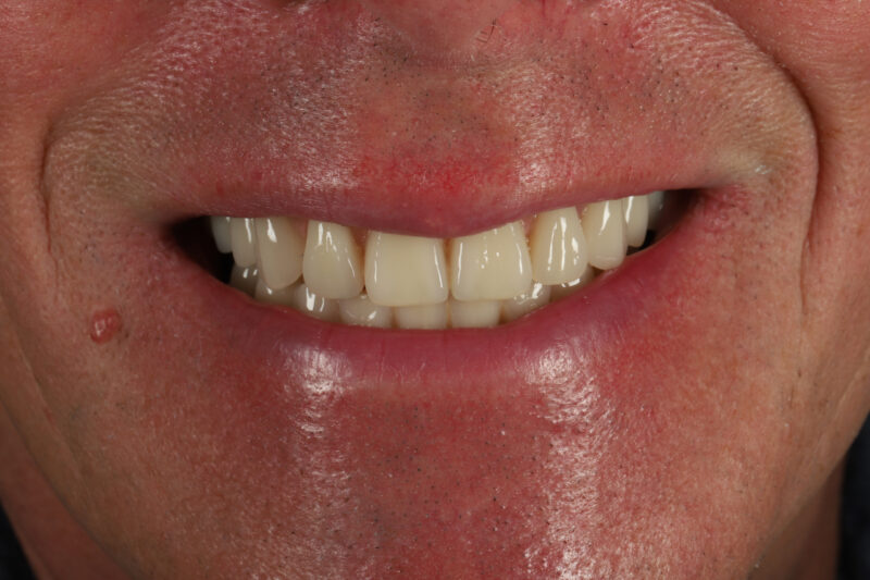 After - Cheadle Hulme Dental