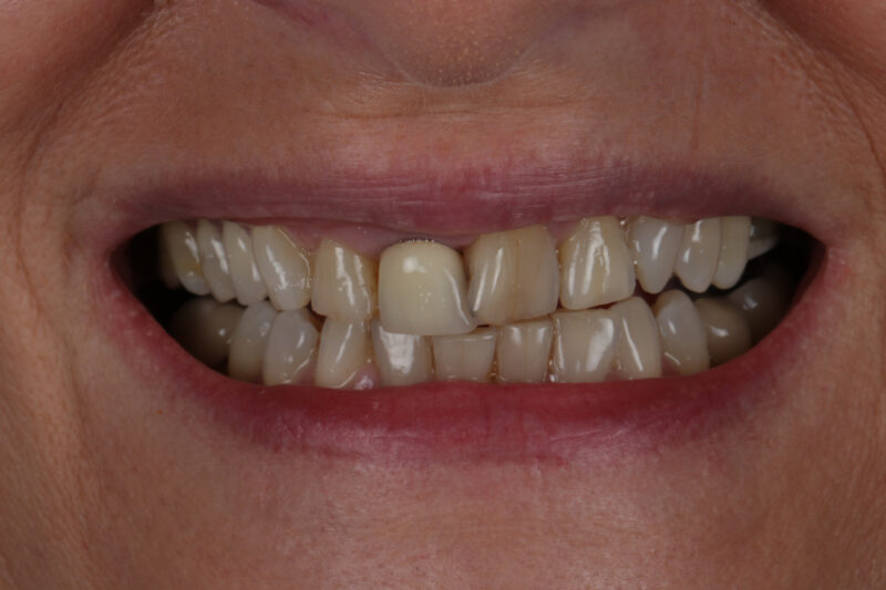 Before - Cheadle Hulme Dental