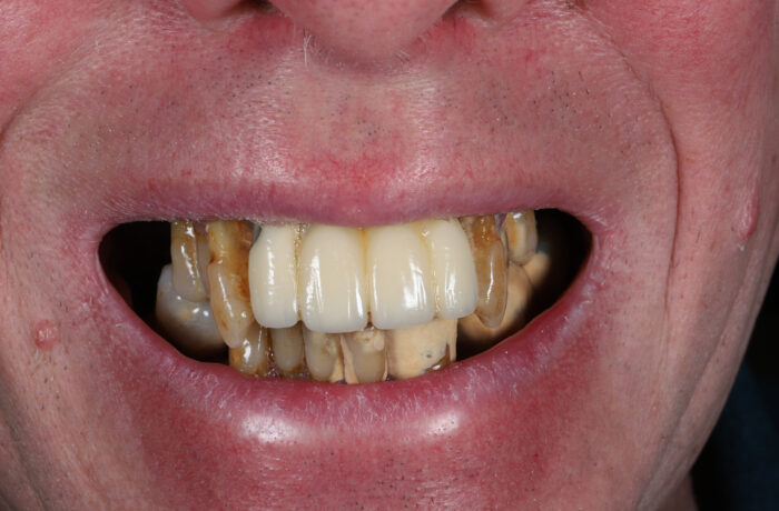 Before - Cheadle Hulme Dental