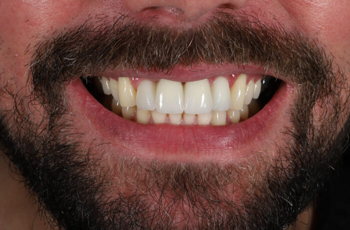 After - Cheadle Hulme Dental