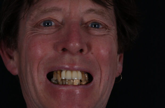Before - Cheadle Hulme Dental