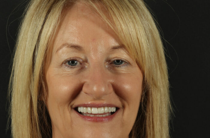 After - Cheadle Hulme Dental