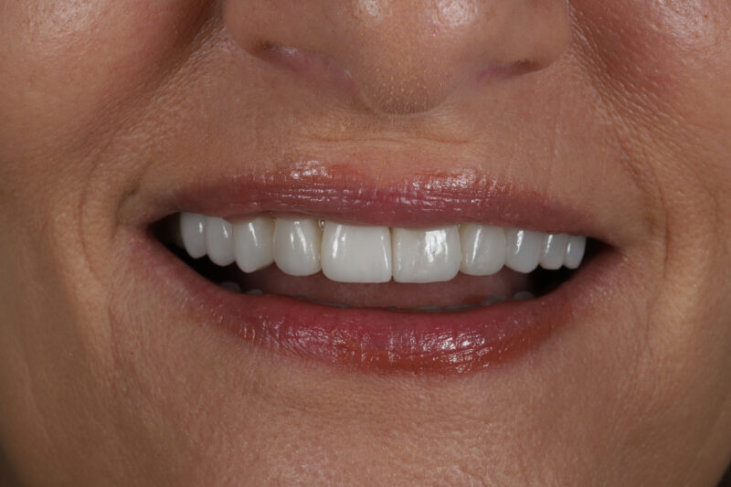 After - Cheadle Hulme Dental