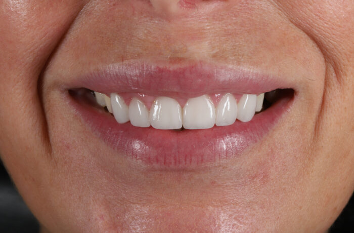 After - Cheadle Hulme Dental